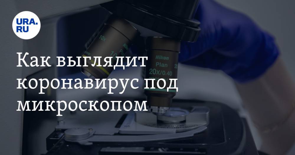 Как выглядит коронавирус под микроскопом. ФОТО - ura.news - Новосибирск - Китай - Ухань