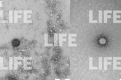 Коронавирус показали под микроскопом - lenta.ru - Новосибирск