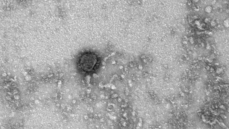 Опубликованы первые снимки коронавируса под микроскопом - gazeta.ru
