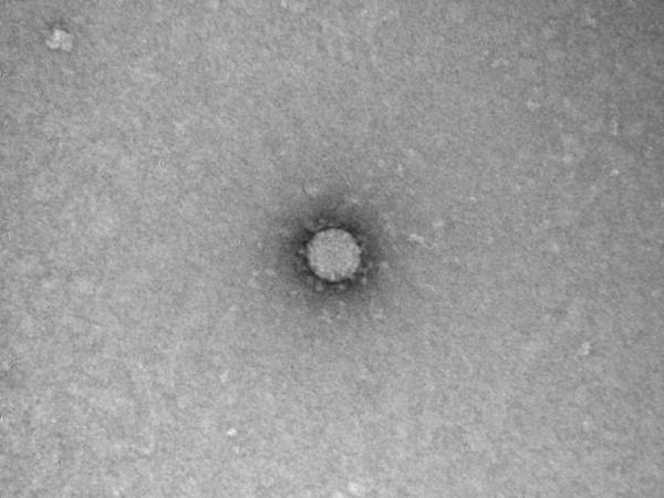 Российские ученые показали "фото" коронавируса - nakanune.ru - Китай - Бразилия