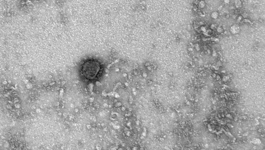 Российские ученые показали, как выглядит коронавирус под микроскопом - dp.ru