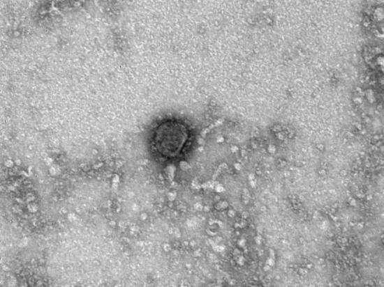Российские ученые опубликовали первые снимки коронавируса под микроскопом - newtvnews.ru
