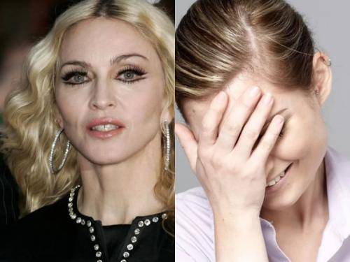Шутки с ботоксом плохи! «Уплывшее» лицо Мадонны обескуражило Сеть - vistanews.ru