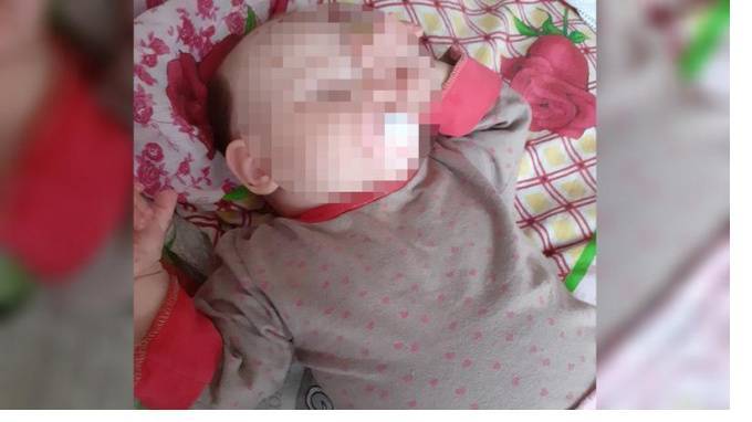 Мама девочки с гигантским родимым пятном рассказала о лечении дочери и травле в сети - piter.tv - Россия - Санкт-Петербург