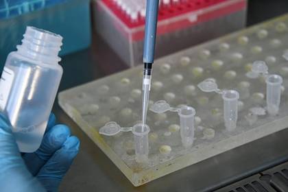 Джеки Ин - Ученые создали экспресс-тест на коронавирус - lenta.ru - Сингапур