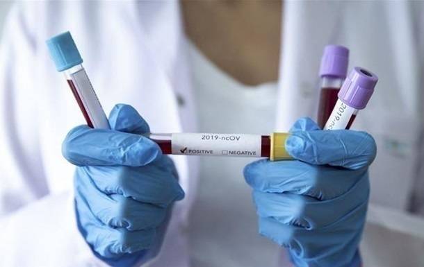 В Житомире экспресс-тест на коронавирус показал ложный результат - korrespondent.net - Украина - Житомир