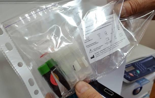 Виктор Ляшко - Украинские компании выпустят два млн тестов на коронавирус - korrespondent.net - Украина - Минздрав