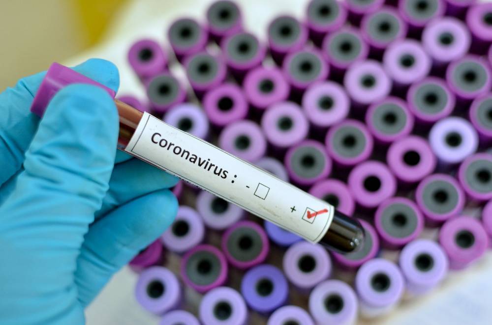 За сутки в Украине выявлено 119 новых случаев коронавирусной болезни - inform.zp.ua - Украина