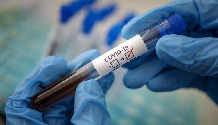 В России создали высокоточный тест для диагностики COVID-19 - newtvnews.ru - Россия