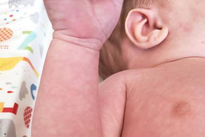 Мать зараженного коронавирусом младенца перечислила симптомы болезни - lenta.ru