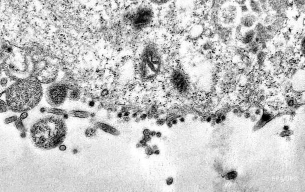 Сделаны фото атаки клеток COVID-19 под микроскопом - korrespondent.net - Бразилия