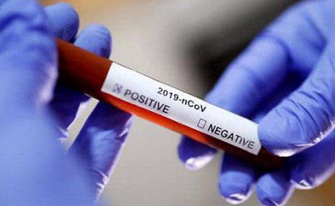 В Грузии проводят «агрессивное тестирование» военных на коронавирус - eadaily.com - Грузия - Минздрав