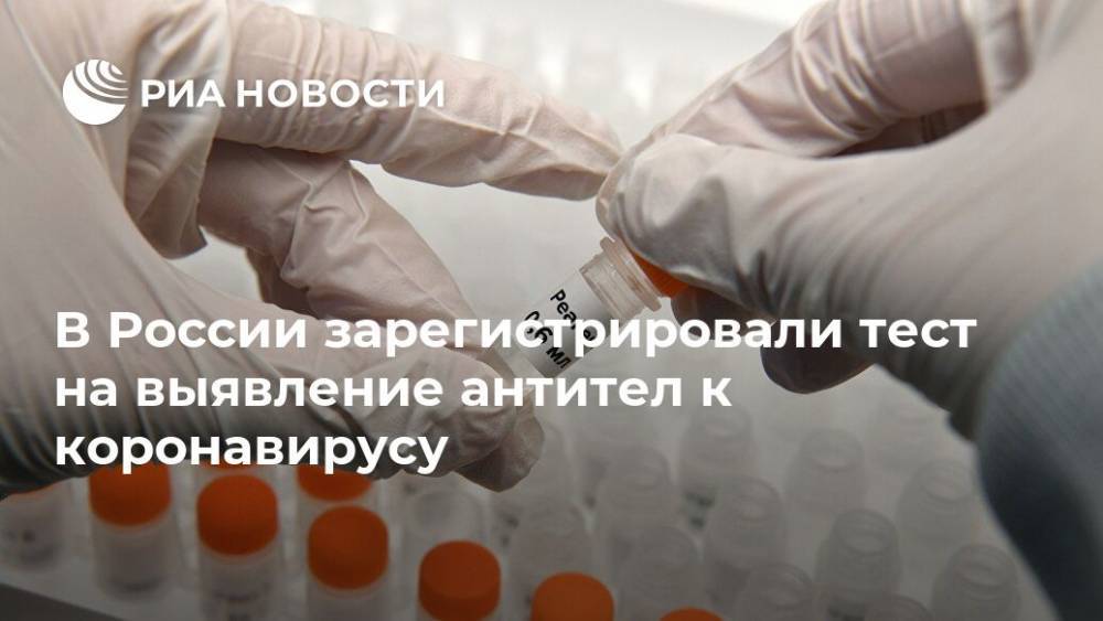 В России зарегистрировали тест на выявление антител к коронавирусу - ria.ru - Россия - Москва