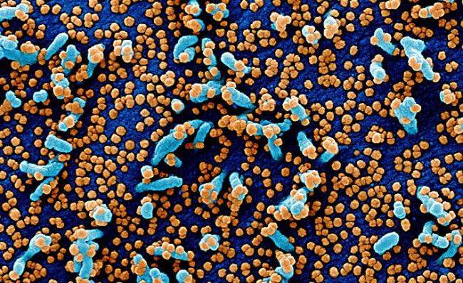 Forskning: Как долго коронавирус выживает на поверхностях и в воздухе - eadaily.com