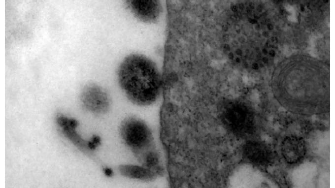 Момент заражения коронавирусом показали под микроскопом - piter.tv - Бразилия