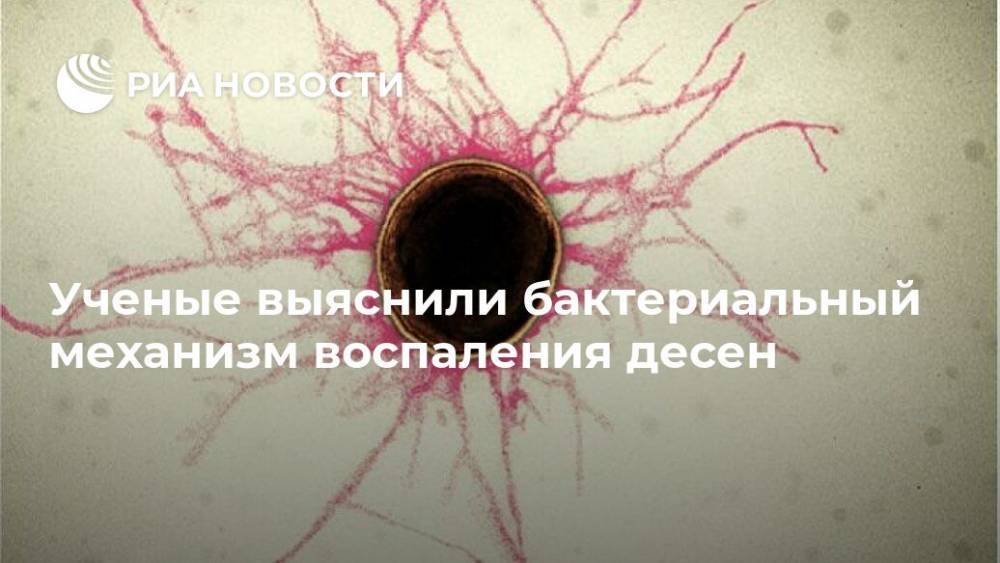 Ученые выяснили бактериальный механизм воспаления десен - ria.ru - Москва