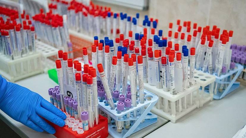 В России зарегистрировано 11 тест-систем для диагностики коронавируса - russian.rt.com - Россия
