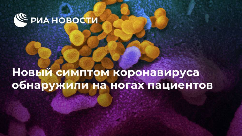 Новый симптом коронавируса обнаружили на ногах пациентов - ria.ru - Москва - Сша - Испания