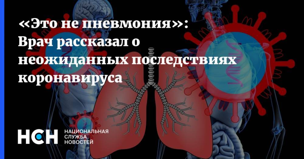 Александр Эдигер - «Это не пневмония»: Врач рассказал о неожиданных последствиях коронавируса - nsn.fm