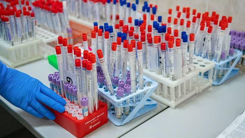 Ленар Валеев - Разработчик рассказал подробности о новом экспресс-тесте на коронавирус - russian.rt.com - Россия