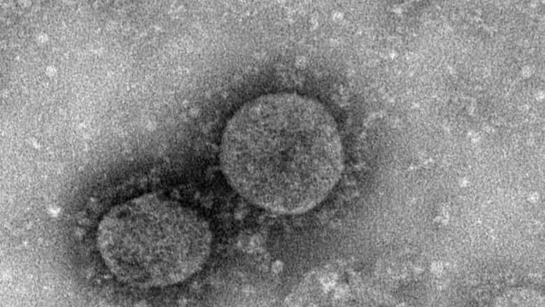 Ученые определили температуру гибели коронавируса - newizv.ru