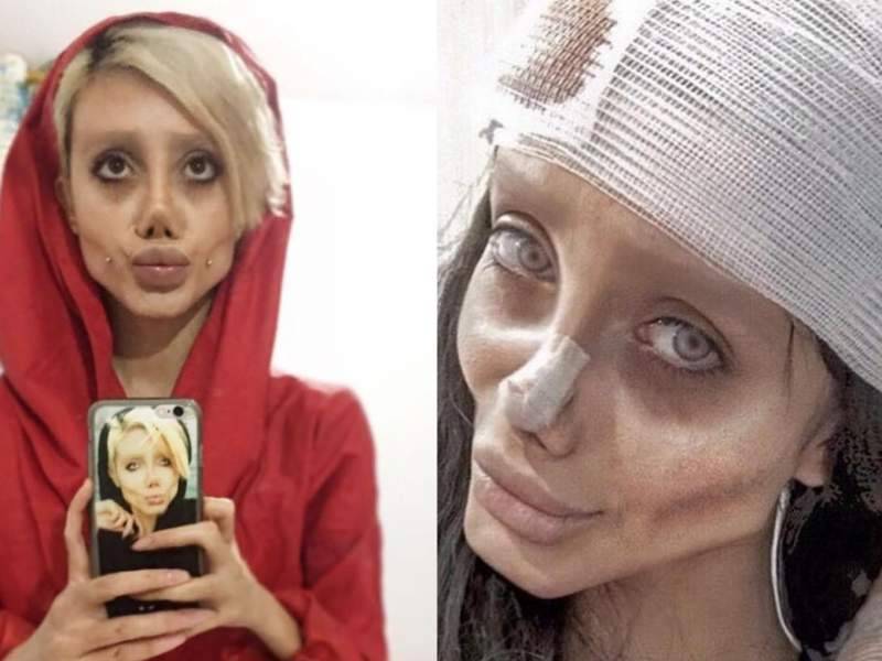 "Иранская Джоли" заразилась коронавирусом в тюрьме: ее подключили к ИВЛ - dayonline.ru
