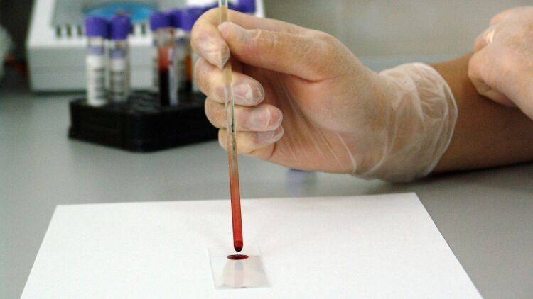 Онищенко оценил метод забора крови переболевших COVID-19 для борьбы с вирусом - inforeactor.ru - Москва