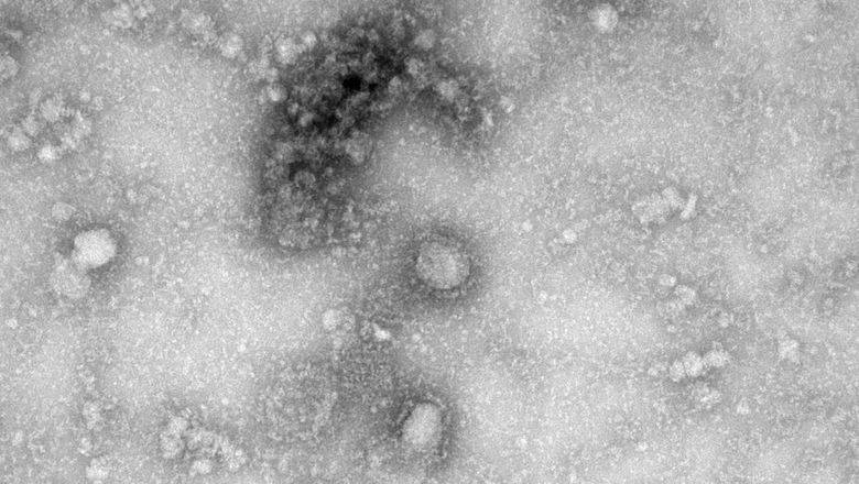 «Все непонятное – страшно»: инфекционист ФМБА рассказал о странностях коронавируса - newizv.ru - Россия