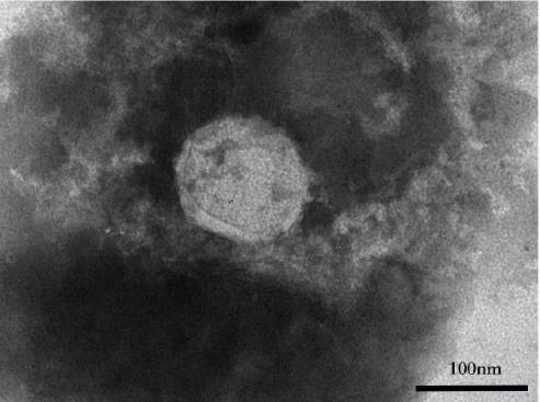 В Ухане экспериментировали, соединяя частицы коронавируса и ВИЧ - eadaily.com - Ухань - Саудовская Аравия