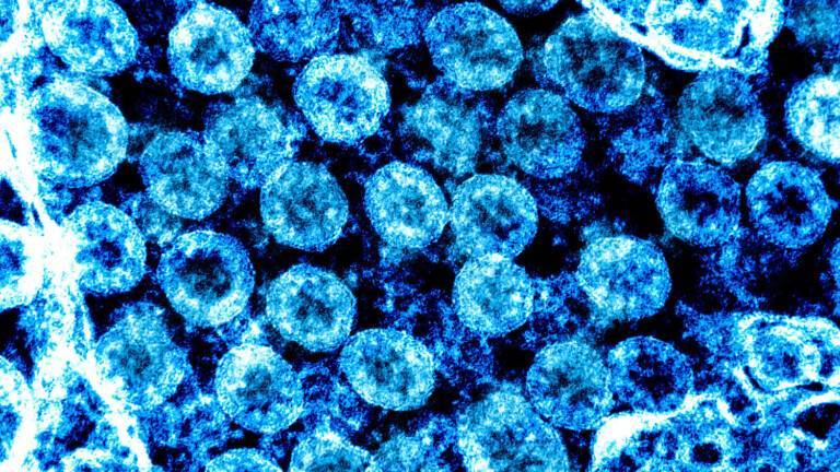 Обнаружен новый симптом коронавируса, который проявляется у детей - germania.one - Италия - Германия