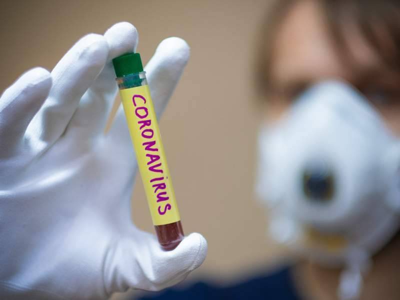 Россиянам разъяснили, можно ли заразиться коронавирусом от предмета - dayonline.ru