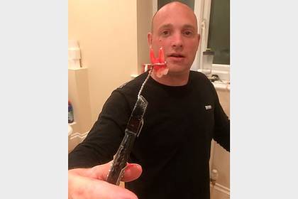 Мужчина отчаялся найти стоматолога в эпидемию и сам вырвал больной зуб - lenta.ru