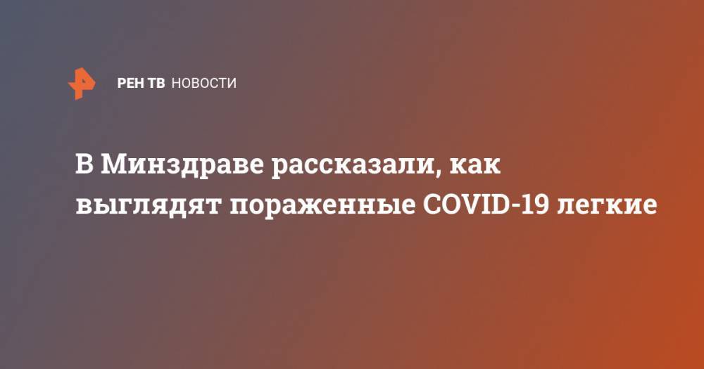 Сергей Авдеев - В Минздраве рассказали, как выглядят пораженные COVID-19 легкие - ren.tv