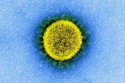 Ученые выявили самые уязвимые для коронавируса клетки человека - lenta.ru - Сша - Бостон