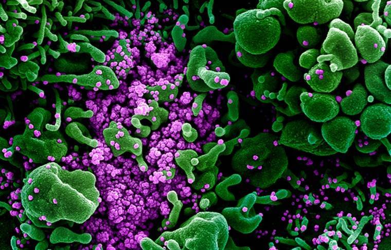Учёные обнаружили уязвимые для коронавируса клетки человека - news.ru