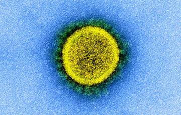 Врачи выявили самые уязвимые для коронавируса клетки человека - charter97.org - Сша - Бостон