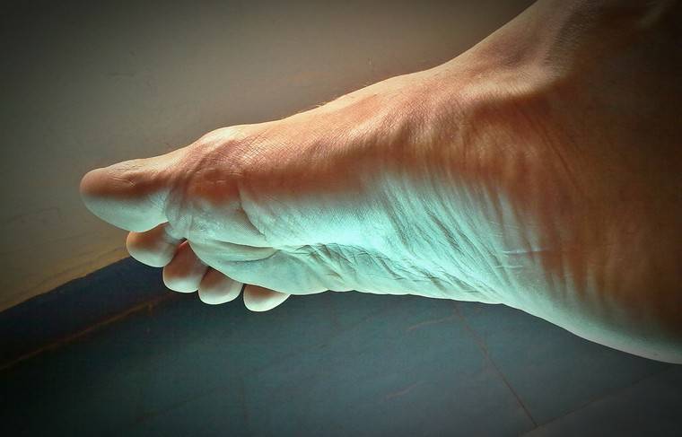 Посинение пальцев ног оказалось симптомом COVID-19 - news.ru