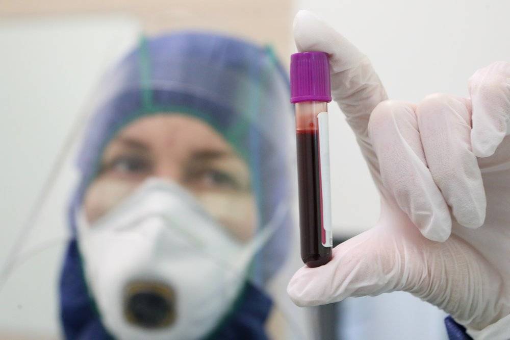 Более 25 тысяч тестов на коронавирус каждый день проводят в Москве - vm.ru - Россия - Москва