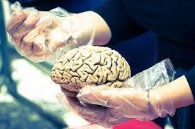 Коронавирус может приводить к поражению мозга, а мужчины заболевают чаще – Минздрав - nakanune.ru - Минздрав