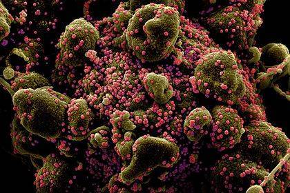 Лекарство от рака применят для борьбы с коронавирусом - lenta.ru - Англия - штат Айова