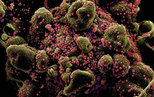 Атака коронавируса под микроскопом: фотогалерея - korrespondent.net