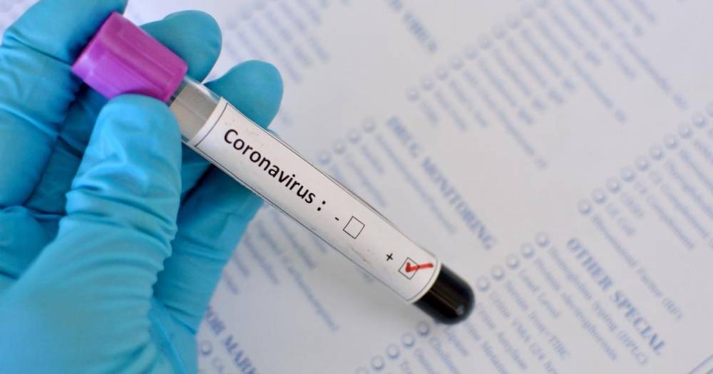 В Украине зафиксировано 1308 случаев коронавирусной болезни COVID-19 - inform.zp.ua - Украина
