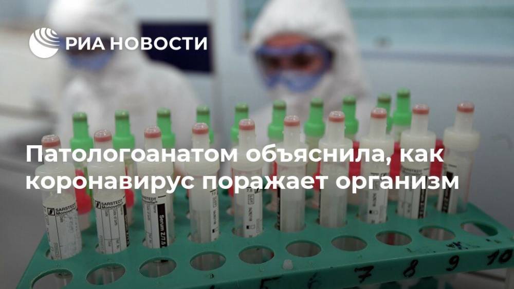 Дарья Ситовская - Патологоанатом объяснила, как коронавирус поражает организм - ria.ru - Москва