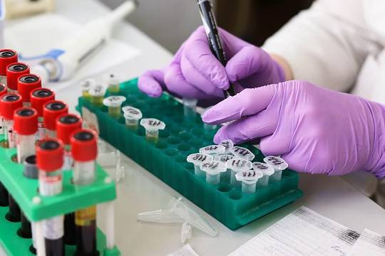 Российские учёные приступили к испытаниям теста для переболевших коронавирусом - versia.ru - Россия