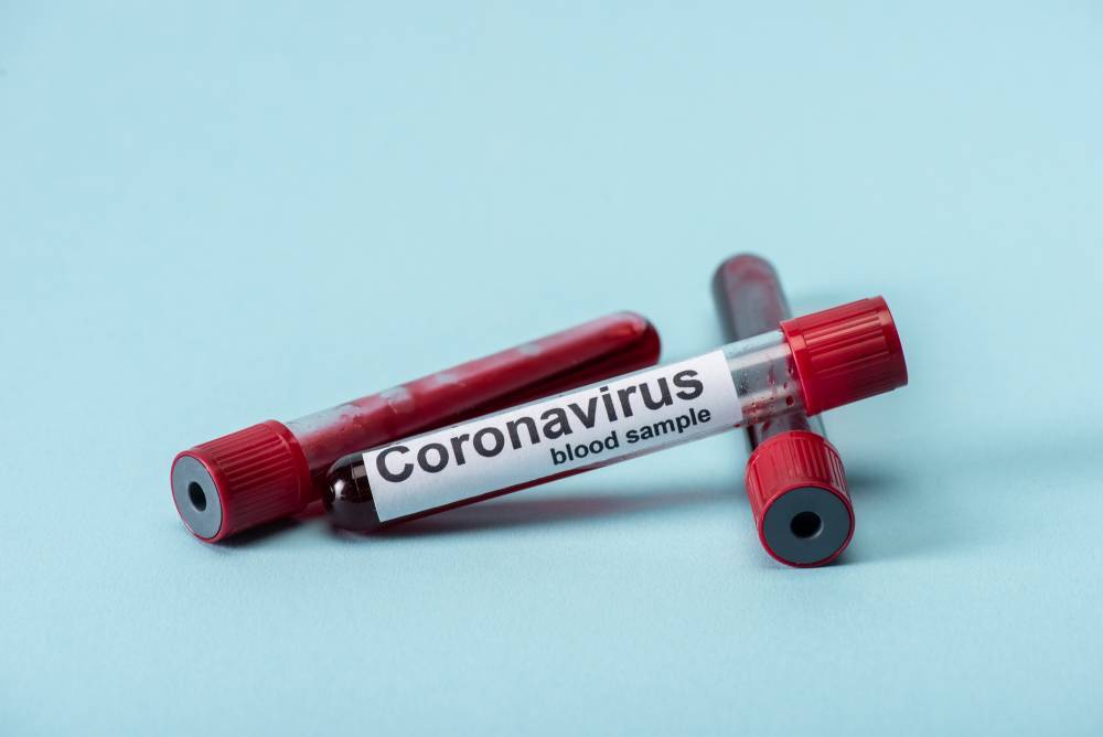 Число заразившихся коронавирусом в Беларуси продолжает расти — уже более тысячи случаев - naviny.by - Белоруссия