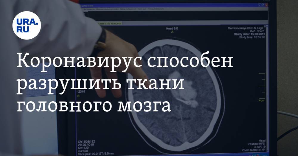 Андрей Козлов - Коронавирус способен разрушить ткани головного мозга - ura.news - Санкт-Петербург