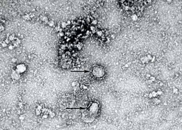 В Австралии нашли подавляющий коронавирус за 48 часов препарат - nakanune.ru - Австралия