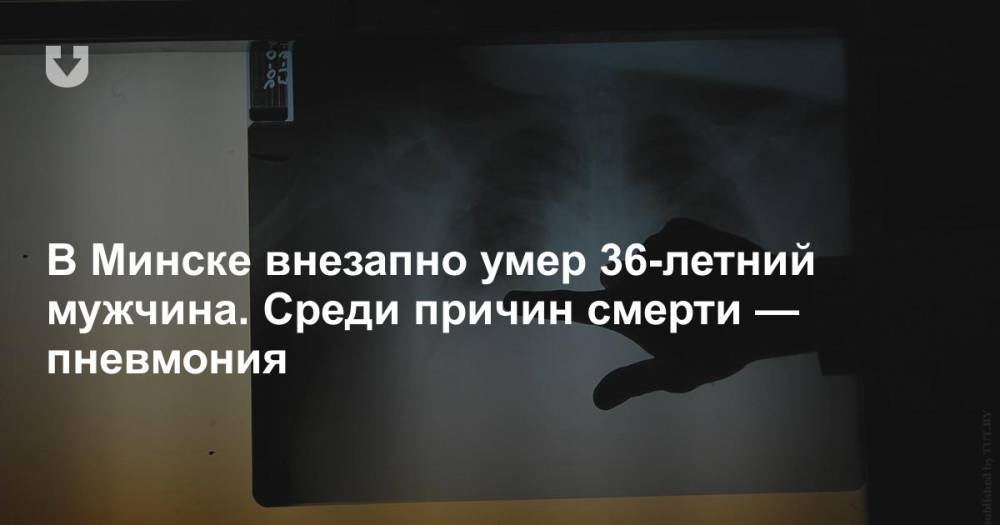 В Минске внезапно умер 36-летний мужчина. Среди причин смерти — пневмония - news.tut.by - Минск