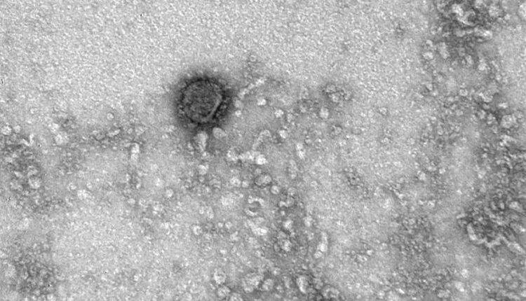 Мелита Вуйнович - В ВОЗ заявили о риске заражения коронавирусом даже при наличии антител - newtvnews.ru - Россия