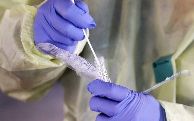 В России зарегистрирован тест для переболевших коронавирусной инфекцией - eadaily.com - Россия